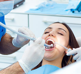 Root Canals